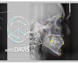 EzOrtho For Smart 3D