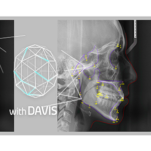 EzOrtho For Smart 3D
